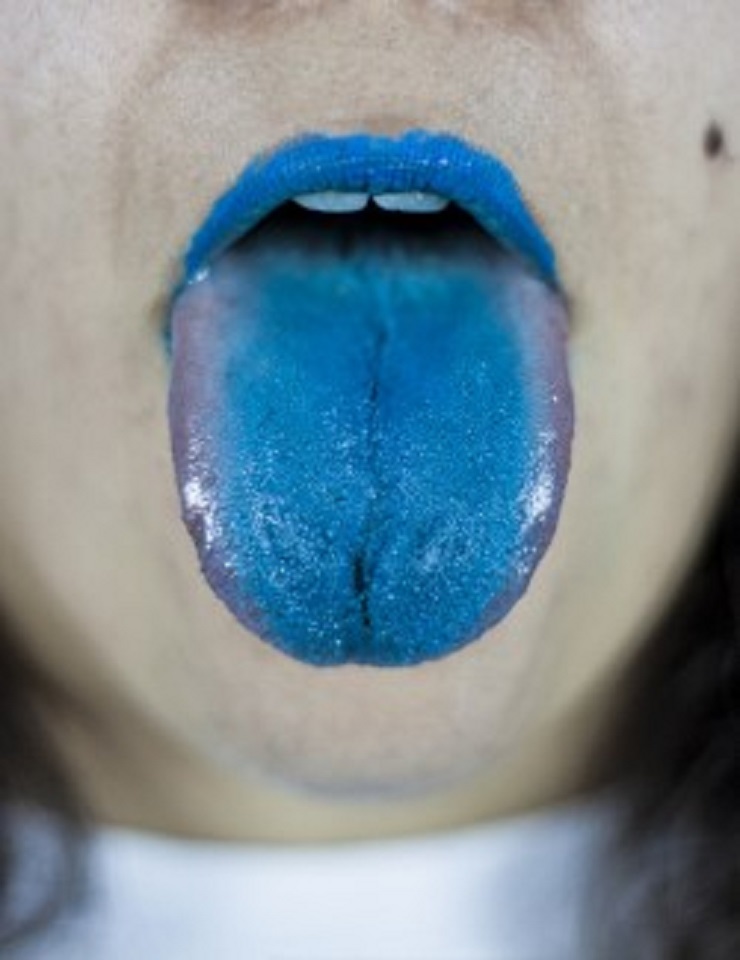 L&iacute;ngua por Estrutura